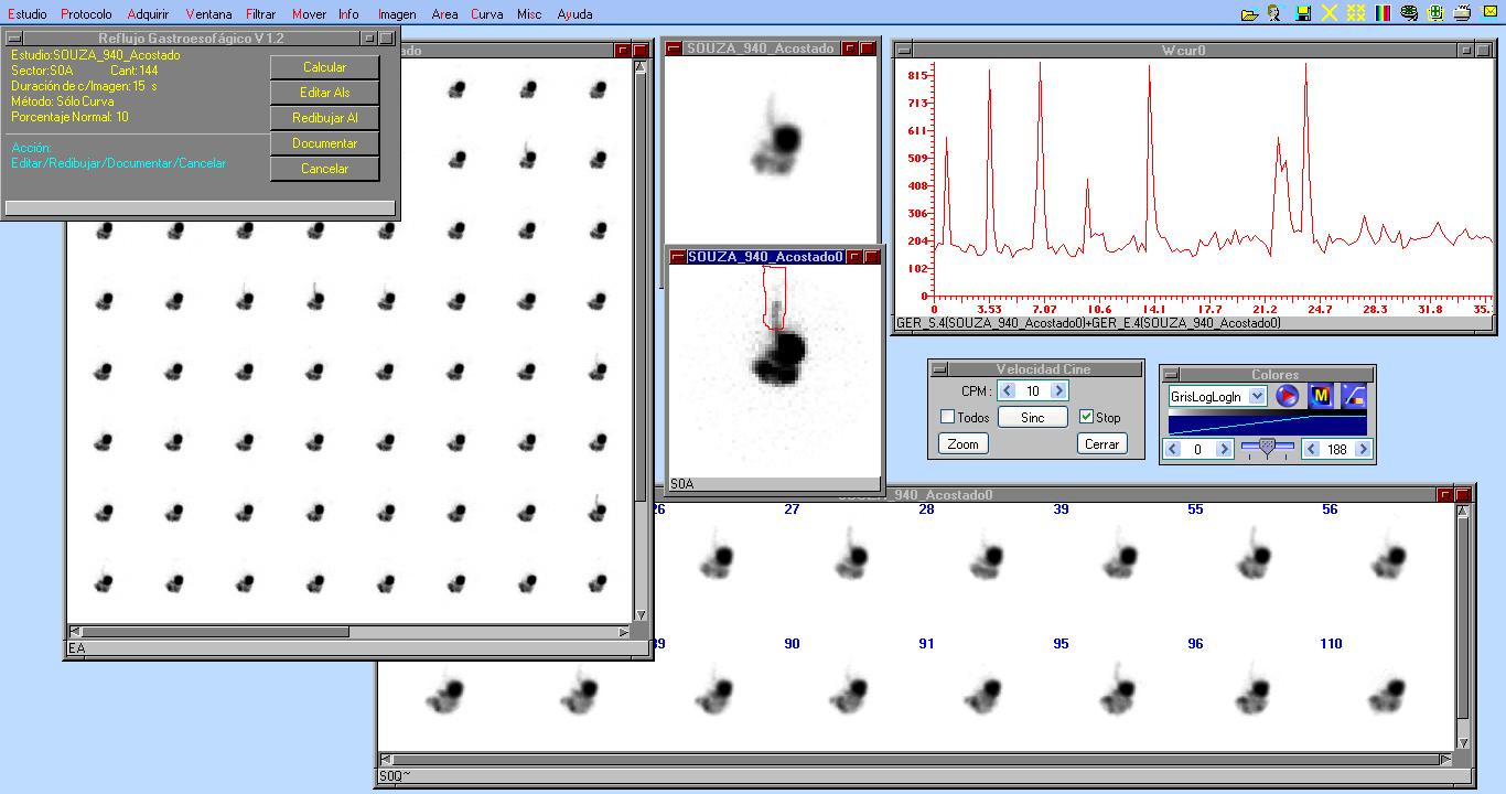 Course Image Procedimientos en Medicina Nuclear I 2026