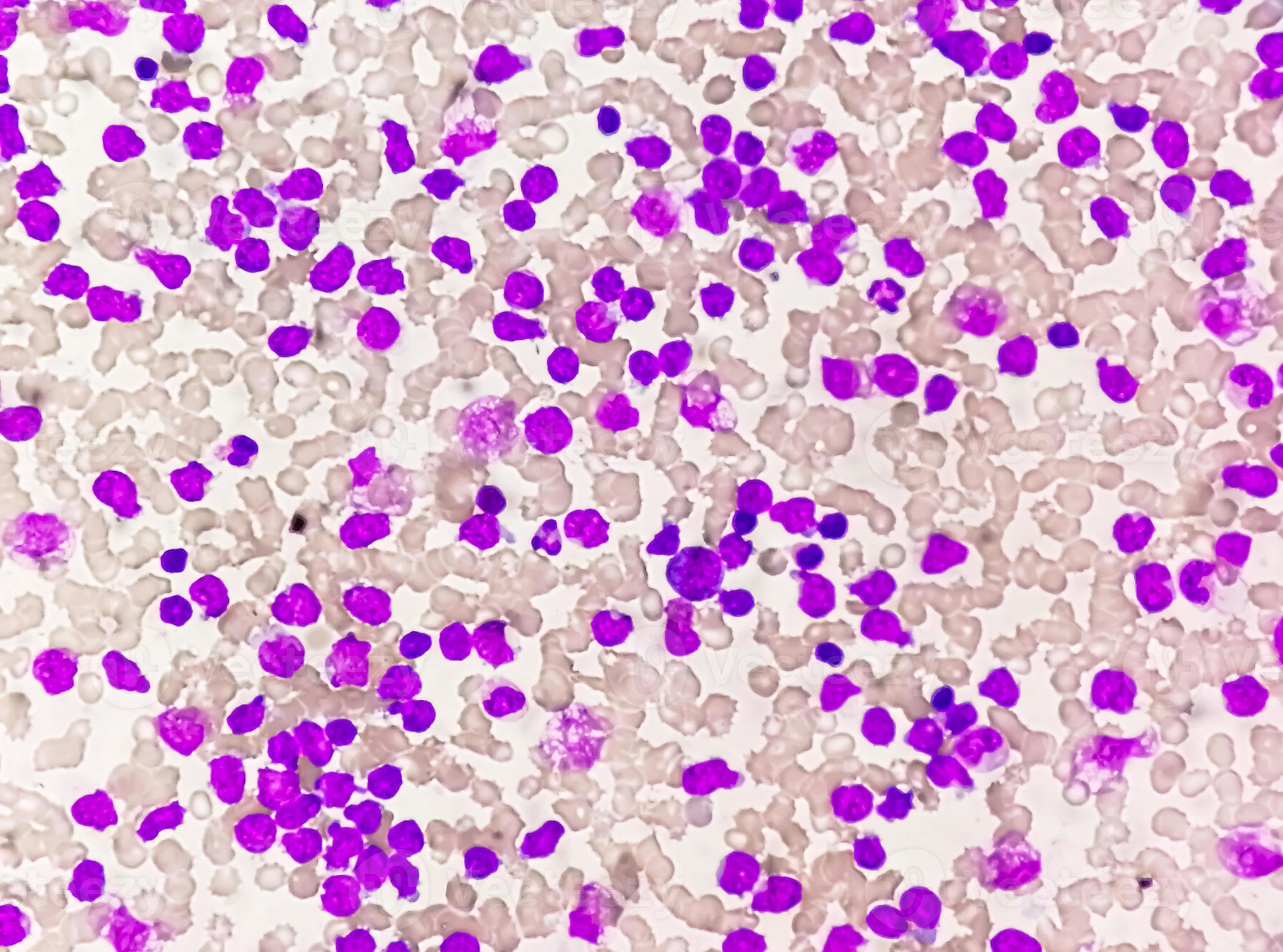 Course Image Bioquímica Clínica II- Área: Hematología 2025